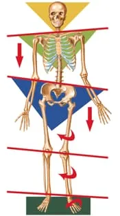 Misaligned Skeleton Pic
