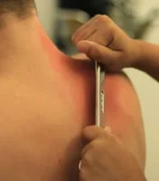 NYC chiropractor uses the Graston technique in SoHo manhattan. Providing Instrument Assisted Soft Tissue Mobilization in NYC Treatment for muscular sprains and strains and sports medicine 