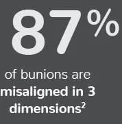 87 percent of bunions are misaligned in 3 dimensions