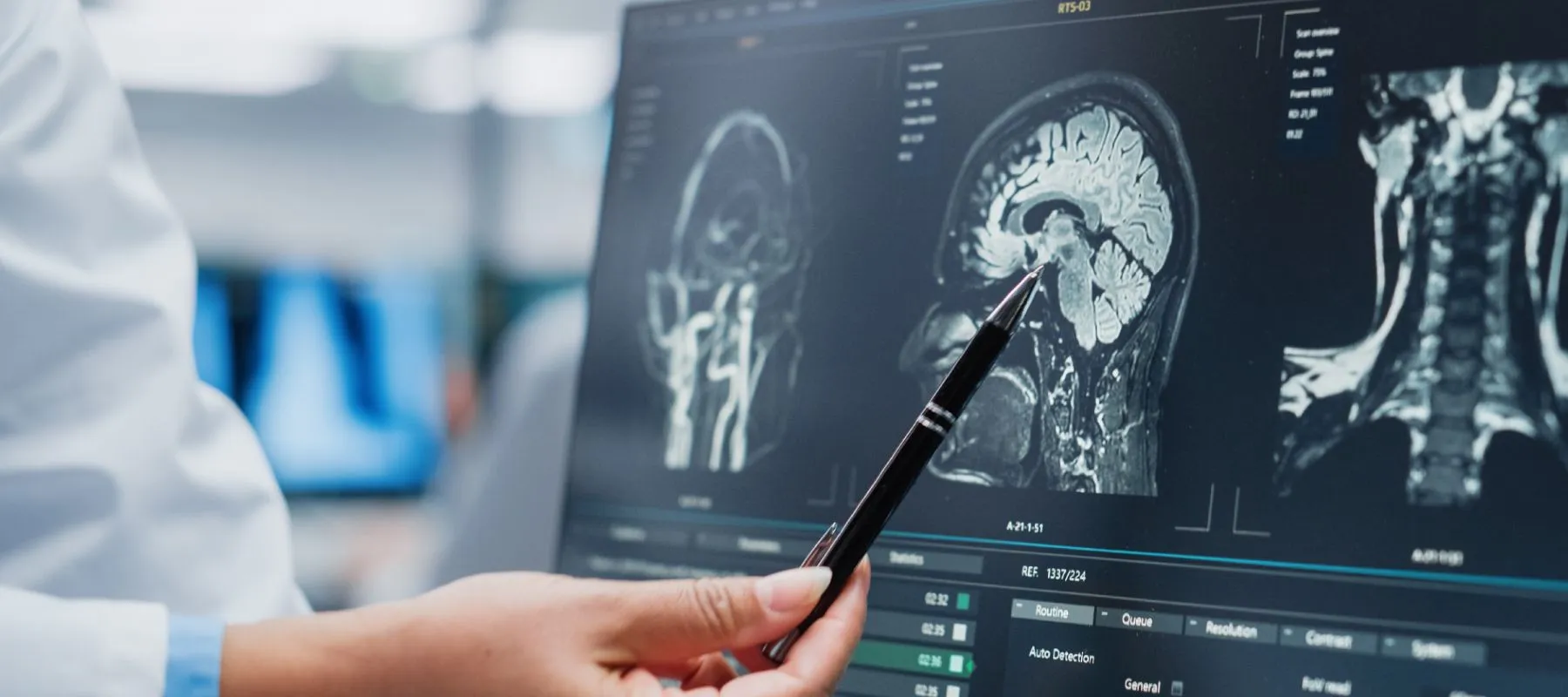 Hand pointing a pen at a computer showing an MRI