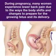 Pregnancy Pain | Basalt, Aspen, Carbondale, Spine Spot Chiropractic