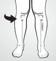 over pronation sign 2 knees in
