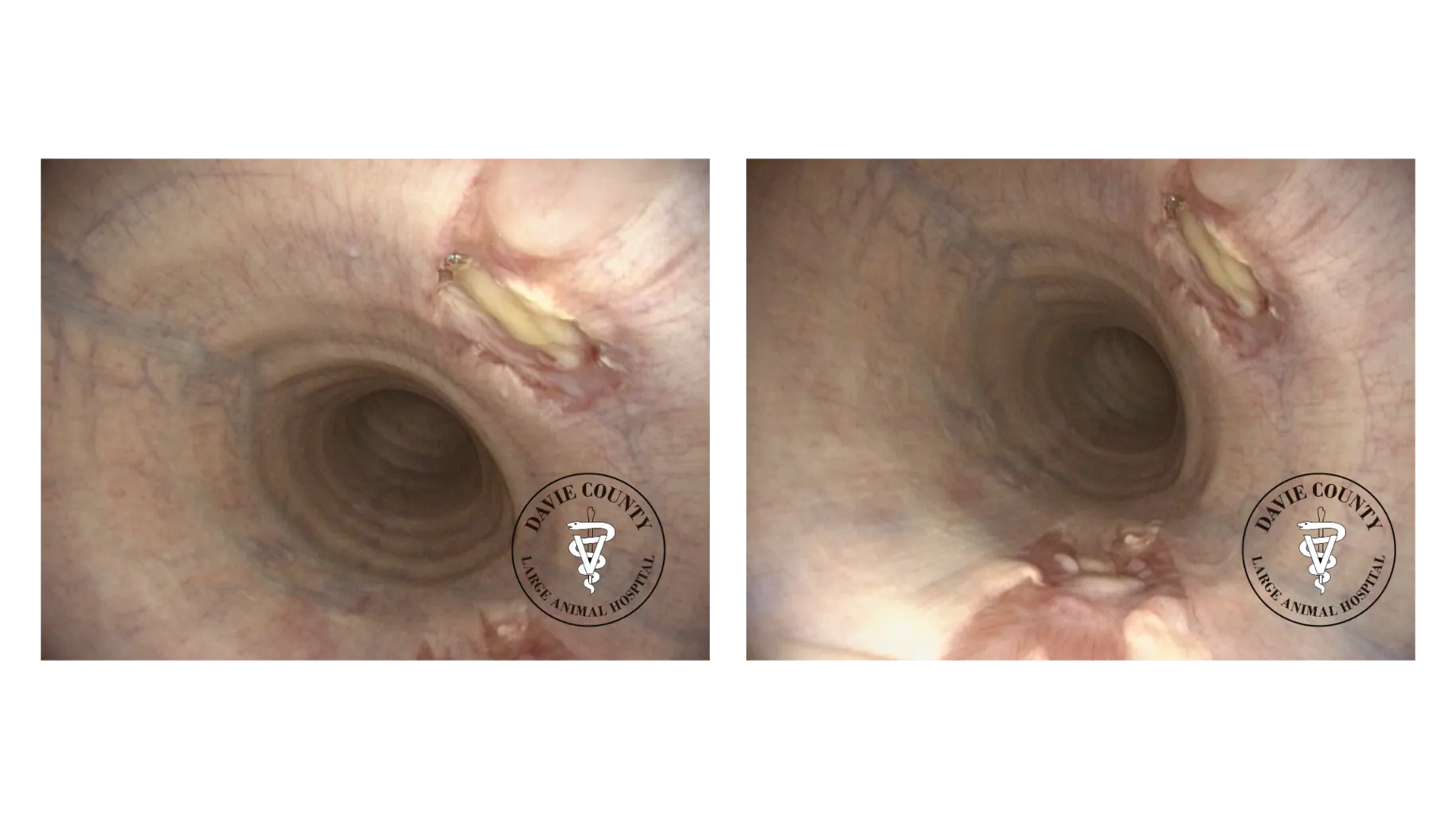 After conservative treatment