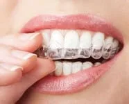 hand holding Invisalign clear teeth aligners against teeth, Invisalign braces in Rockwall, TX