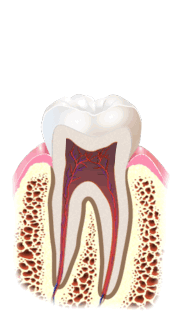 rootcanal-animation