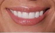Pearl Smile Dental in Milpitas CA