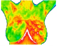 Suspicious vascular activity