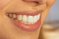 Decatur Cosmetic Dentistry
