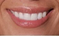 A girl with smiling teeth