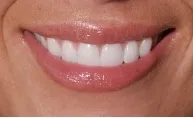 Rajinder Bhullar DDS in Fort Washington MD