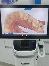 computer screen showing digital impression of a person's lower teeth, dentist New Baltimore, MI