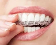 hand holding clear teeth aligners in mouth, Shelby Twp, MI Invisalign treatment