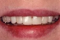 Timeless Smile | Smile Gallery in North Austin