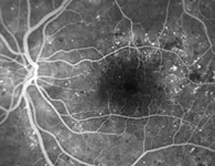 Results of Fundus photography