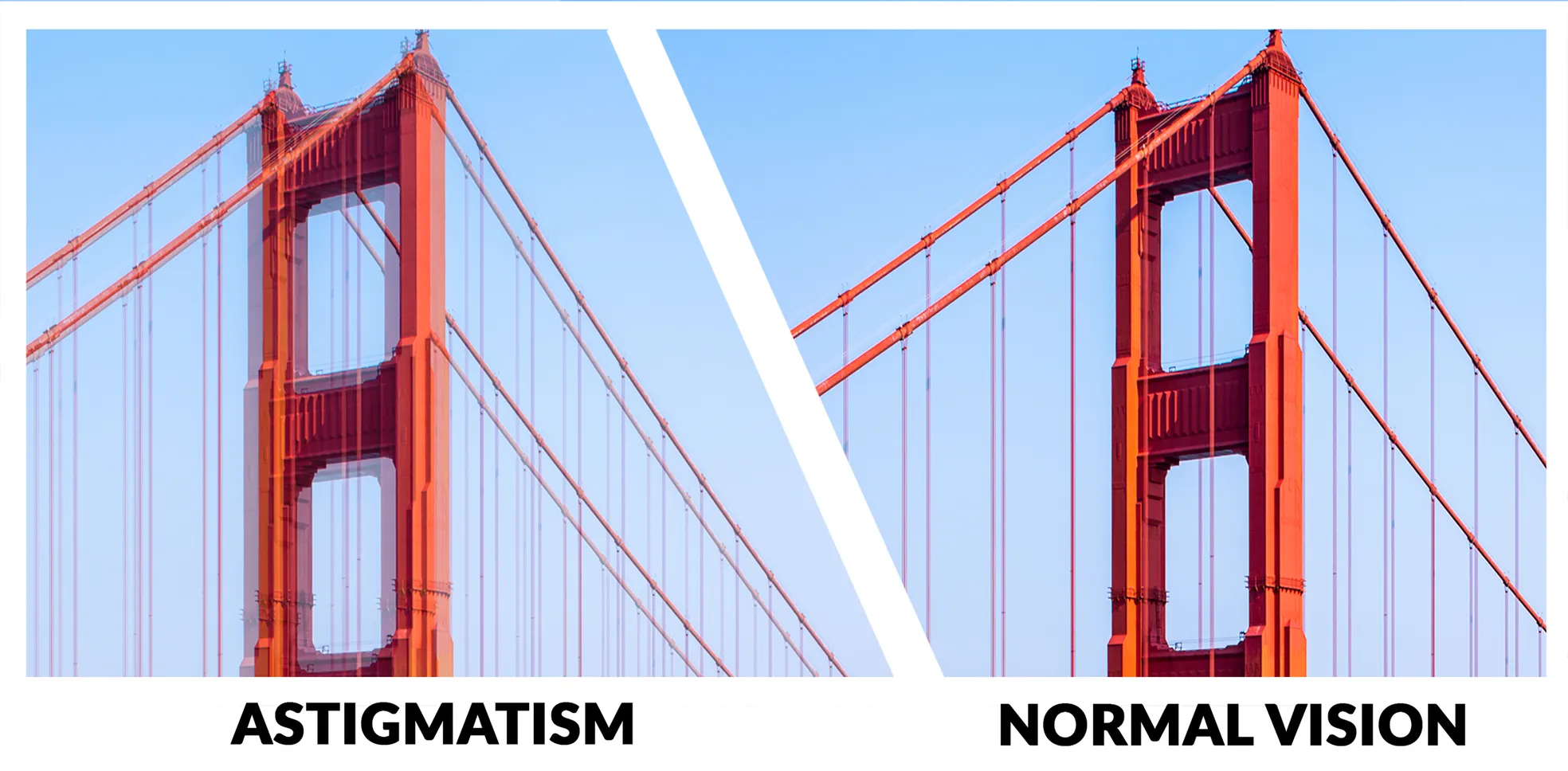 points of view with astigmatism