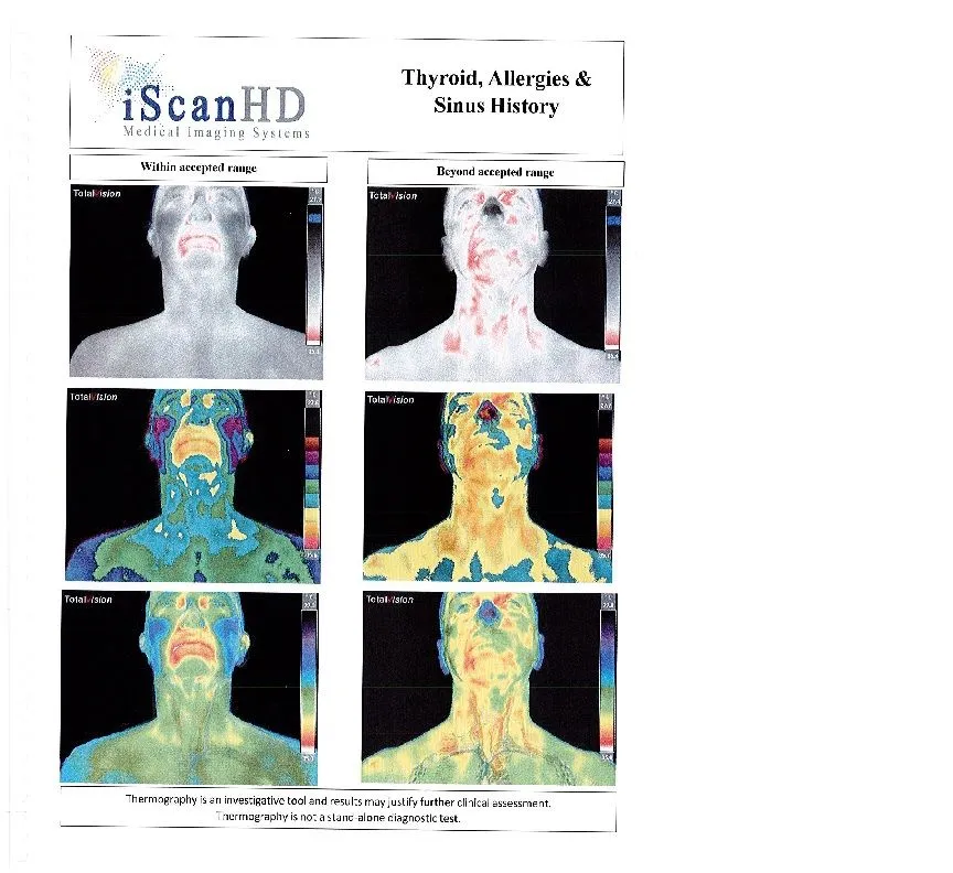 Thermography -- Thyroid, Allergies & Sinus History