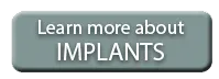 dental implants faqs