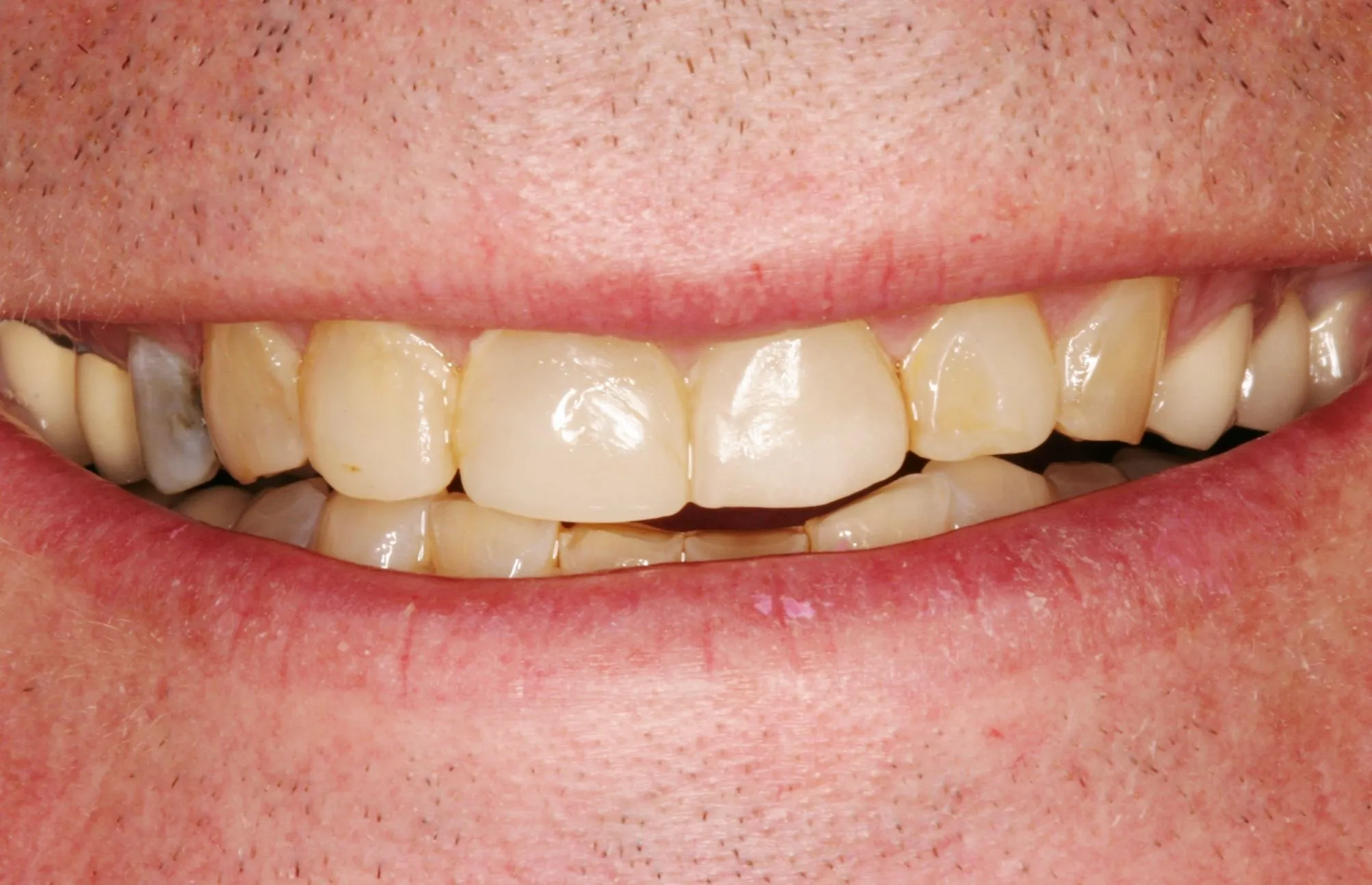 Smileページ Smile Toothpaste