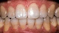 Hartej S. Sood, DDS