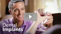 Dental Implant Video