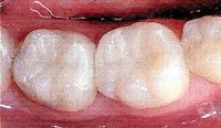 Hartej S. Sood, DDS