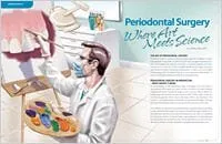 Periodontal (Gum) Disease - Dear Doctor Magazine