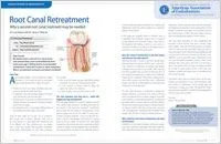 Root Canal Retreatment - Dear Doctor Magazine