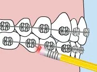 poking-wire