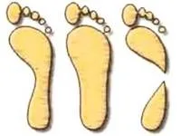 Footprints of three different types of feet: normal, flat-footed, high and rigid arch
