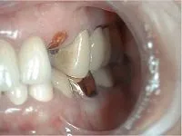 Periodontist in Athens, GA