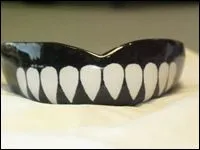 Custom Mouthguard