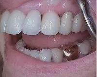Periodontist