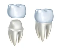 Crowns and Bridges | Dentist In Lexington, VA | Shenandoah Dental Studio