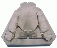 Palatal Expander - Orthodontics
