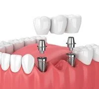 Dental of Heathrow Restorative Dentistry