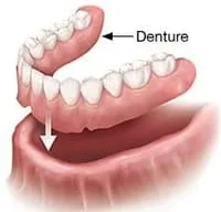 Scarborough Dentures services