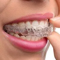 custom mouthguard for teeth grinding and TMJ relief, family dentist Melrose, MA