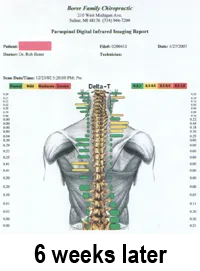 Tytron_FS_Patient_2mo.jpg