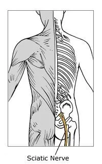 Diagram of sciatic nerve