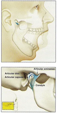 TMJ_occlusion1.png