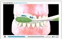 Educational Dental Videos