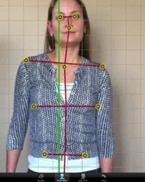 Posture Screening Software-SCJ Article