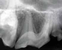 Fractured maxillary carnassial tooth