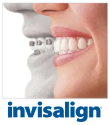 logo for Invisalign and images in background of mouth wearing braces next to mouth wearing clear aligners, Invisalign orthodontics Lawrenceville, GA dentist