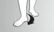 over pronation sign one foot out
