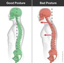 Posture | Basalt, Aspen, Carbondale, Spine Spot Chiropractic