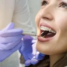 How Conventional Braces Straighten Your Teeth