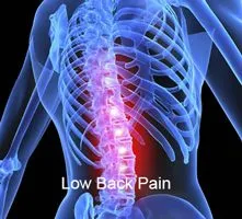 low back pain