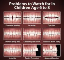 chart showing multiple images of children's teeth with various orthodontic problems, early orthodontic treatment Sioux Falls, SD