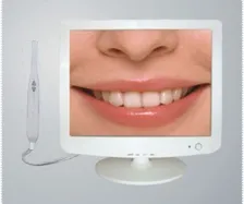 intraoral-camera